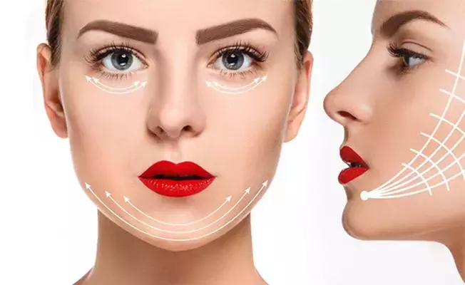 Fransız Askısı Ameliyatsız Yüz Askılama Fiyatları İstanbul